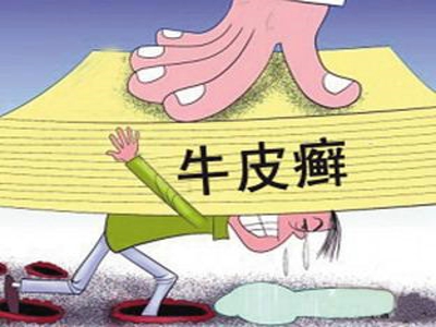 牛皮癣