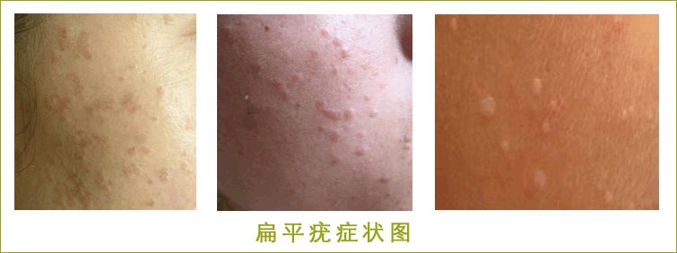 ��ƽ�����Ϸ�������Щ